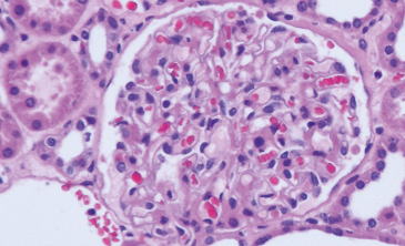 Immunohistochemia