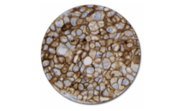 PD-L1 IHC 22C3 pharmDx (Autostainer Link 48)